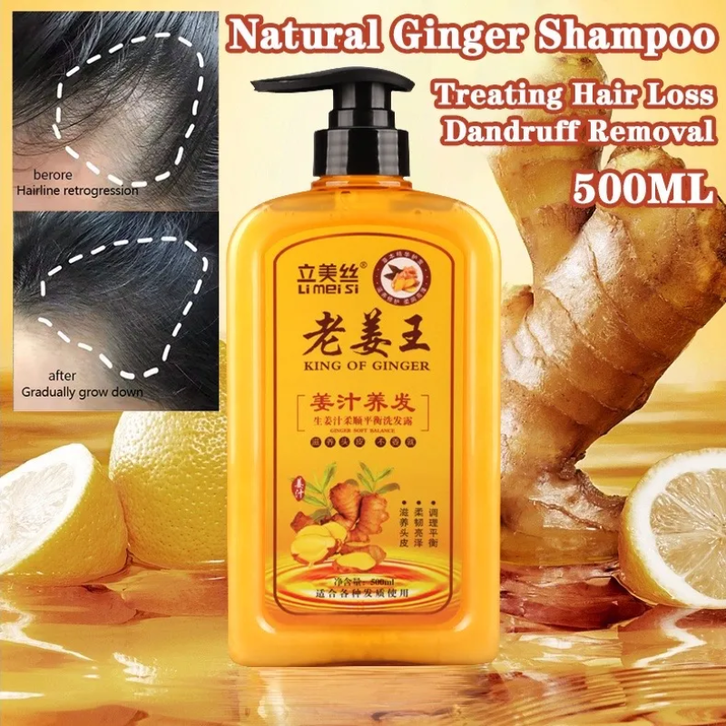 Ginger Wang King of Ginger Anti Hair Loss Ginger Shampoo I Ginger Hair