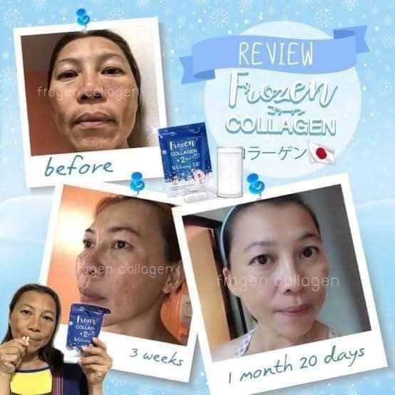Frozen Collagen Authentic 2 In 1 Whitening 10x Original Glutathione Gluta Frozen Best Seller 60 Capsules 100 Natural Cleanse Fat Burn Diet Fast Slim Lazada Ph