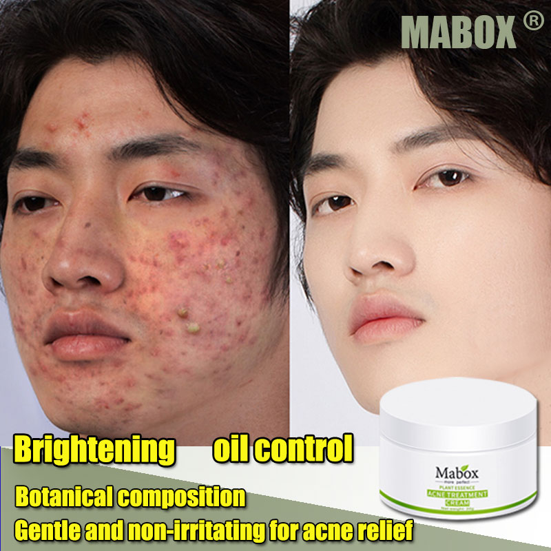 Acne Cream Moisturizing Oil Control Shrink Pores Acne Scar Removal