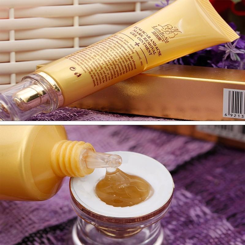 100 Original TCM LanBeNa Acne Scar Mark Removal Gel Ointment 30g