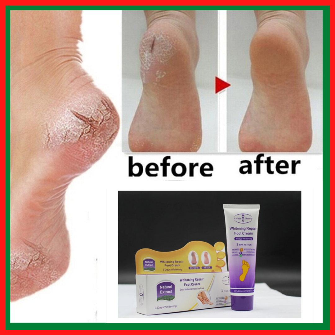 KURAIY Chapped Hand and Foot Cream Crack Peeling Repair Anti Dry Skin  Remove Dead Skin Foot