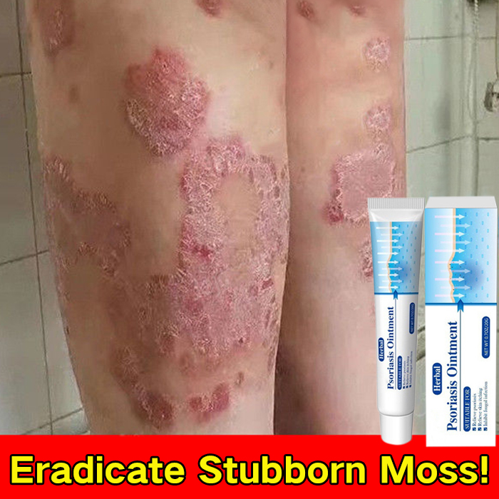100 Herbal Effective Psoriasis Ointment Psoriasis Eczema Cream