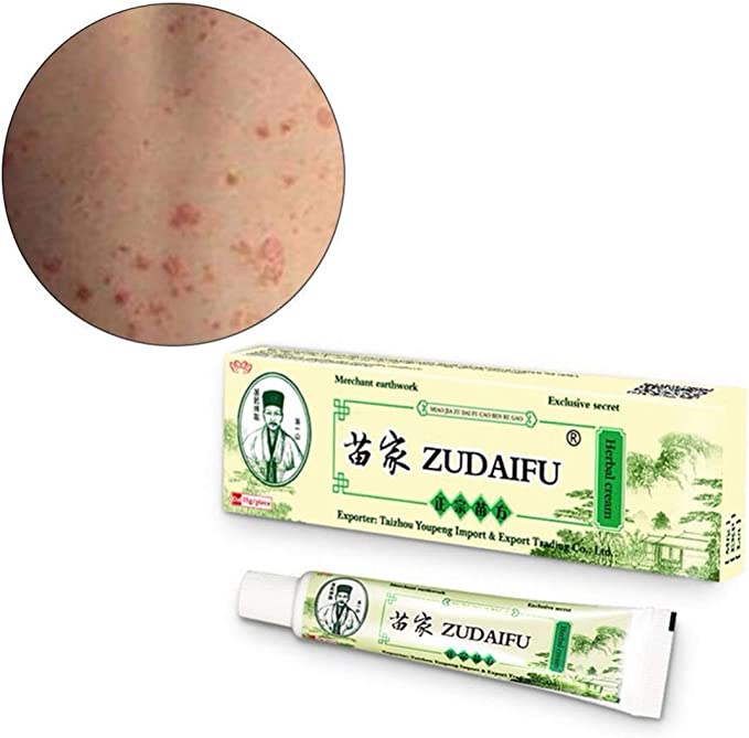 Zudaifu Care Cream Cream Dermatitis Eczematoid Eczema Ointment Cream ...