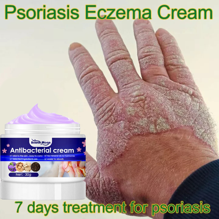 Atoderma Cream Original Gamot sa kati kati sa balat ointment eczema