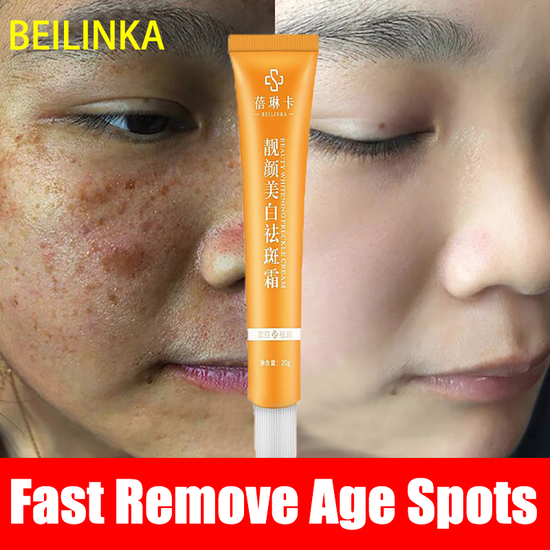 Efficient Remove age spots Melasma Removal Cream Original darkspot