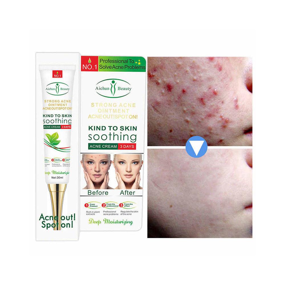 assure fairness cream