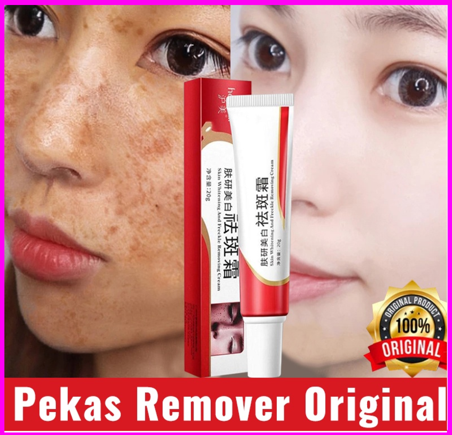 Best Seller Orginal Melasma Cream Whitening Freckle Cream Remove Dark