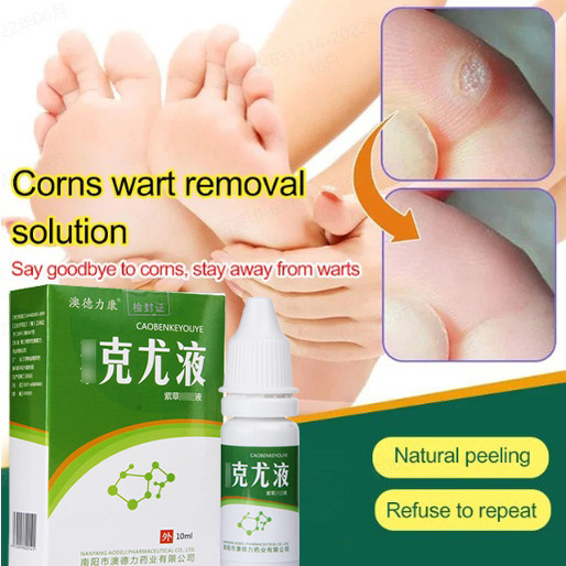 Wart Removal Solution Keyou liquid g wart cream away from warts