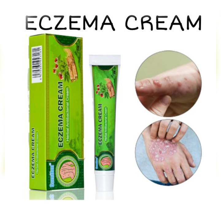 [57 Days Fast Delivery] SUMIFUN 20g Eczema Treatment Cream ORIGINAL Eczema Psoriasis Allergy
