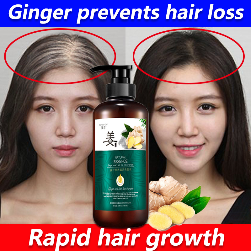 Ginger Prevent Hair Loss Anti Dandruff Shampoo Promote Hair Growth  Effectively Stimulate Rapid Hair Growth Loss Strong Hair Thick Hair Men And  Women Hair Grower | Lazada PH