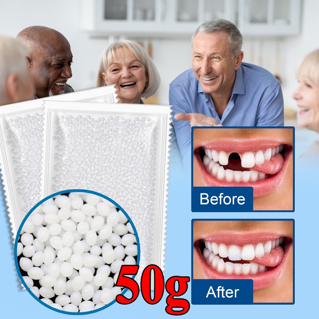 Moldable False Teeth Tooth Repair Granules, Teeth Repair Kit, Diy Temporary  Tooth Repair Beads Tw