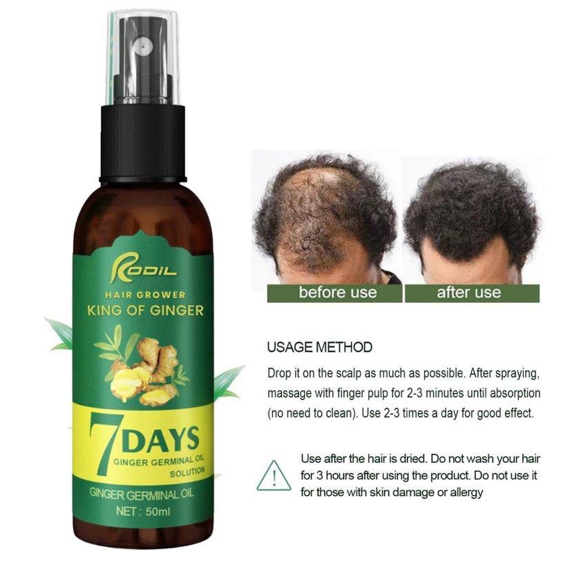 King of Ginger, Rodil King of Ginger, Hair loss Oil, Hair loss
