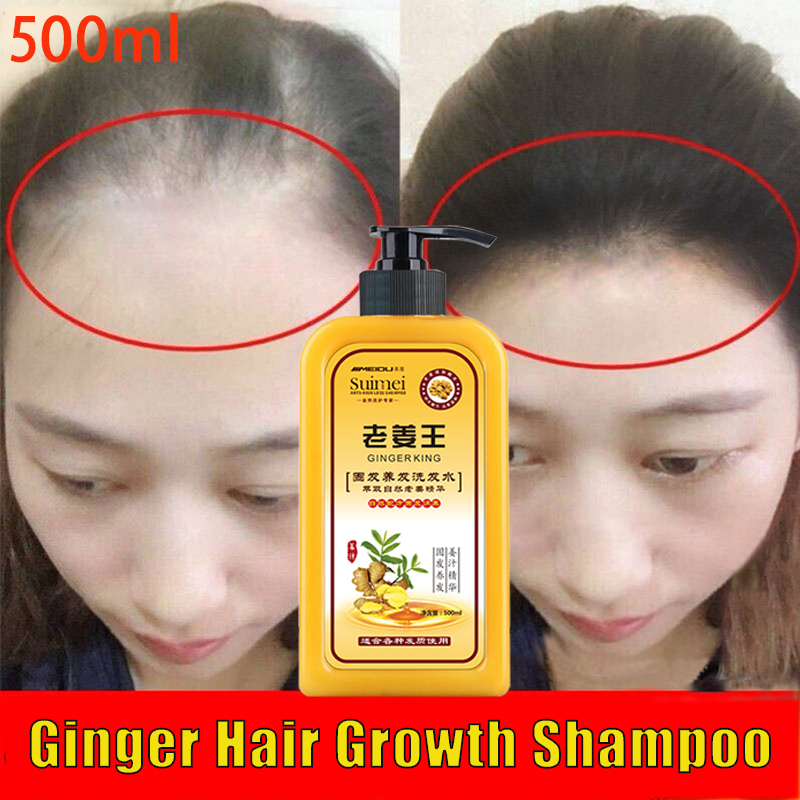 500ml Professional Ginger Shampoo Hair Growth Anti Hair Loss Shampoo Fast Regrowth Hair Thick 7694