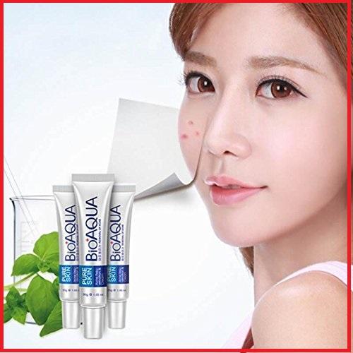 BIOAQUA ACNE & PIMPLES REMOVAL CREAM, Acne Scar Mark Remover Removal