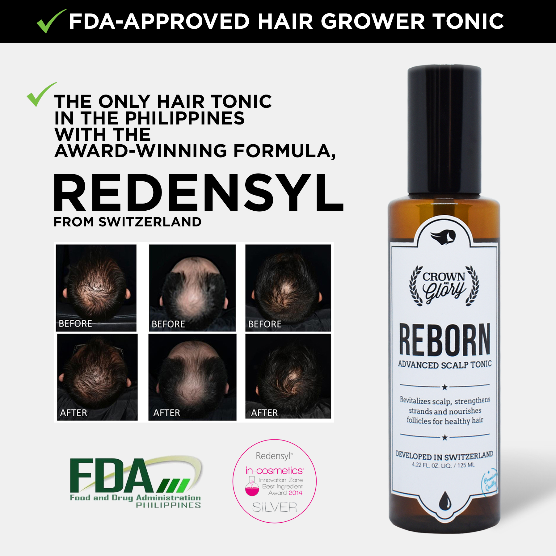 Crown & Glory Reborn Advanced Scalp Tonic with Redensyl® 125mL, Save  PHP451! - turbo boosts hair growth | Lazada PH