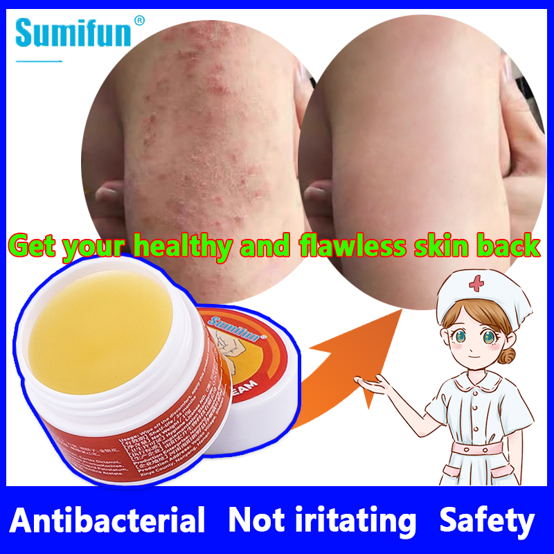 No harm to skin Psoriasis Cream Psoriasis Treatment Cream Psoriasis