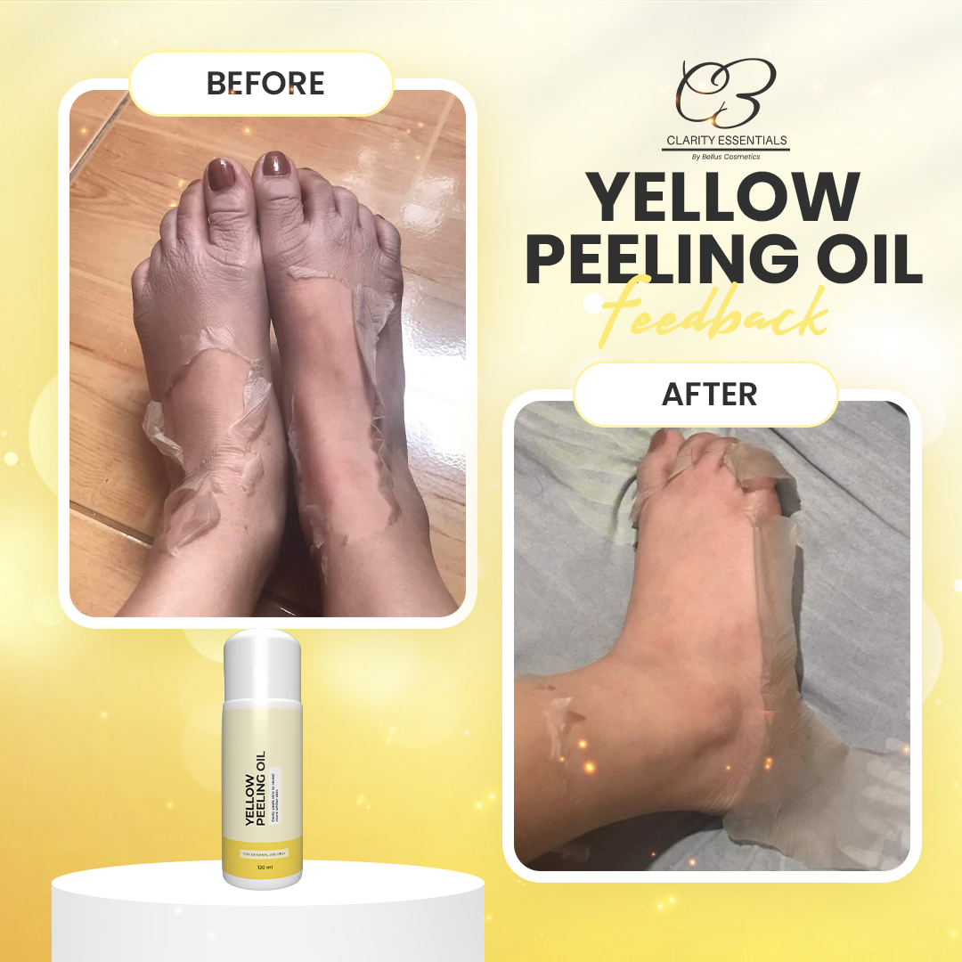 Yellow Peeling Oil 120ml | Clarity Essentials | Skin Peeling - Body ...