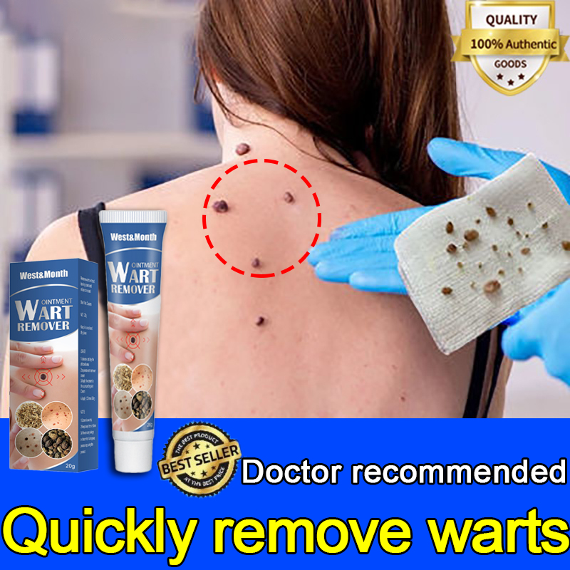 20g Original Wart Removal Ointment Fast Remove Skin Tag Remover Ointment Against Mole And Genital 8829