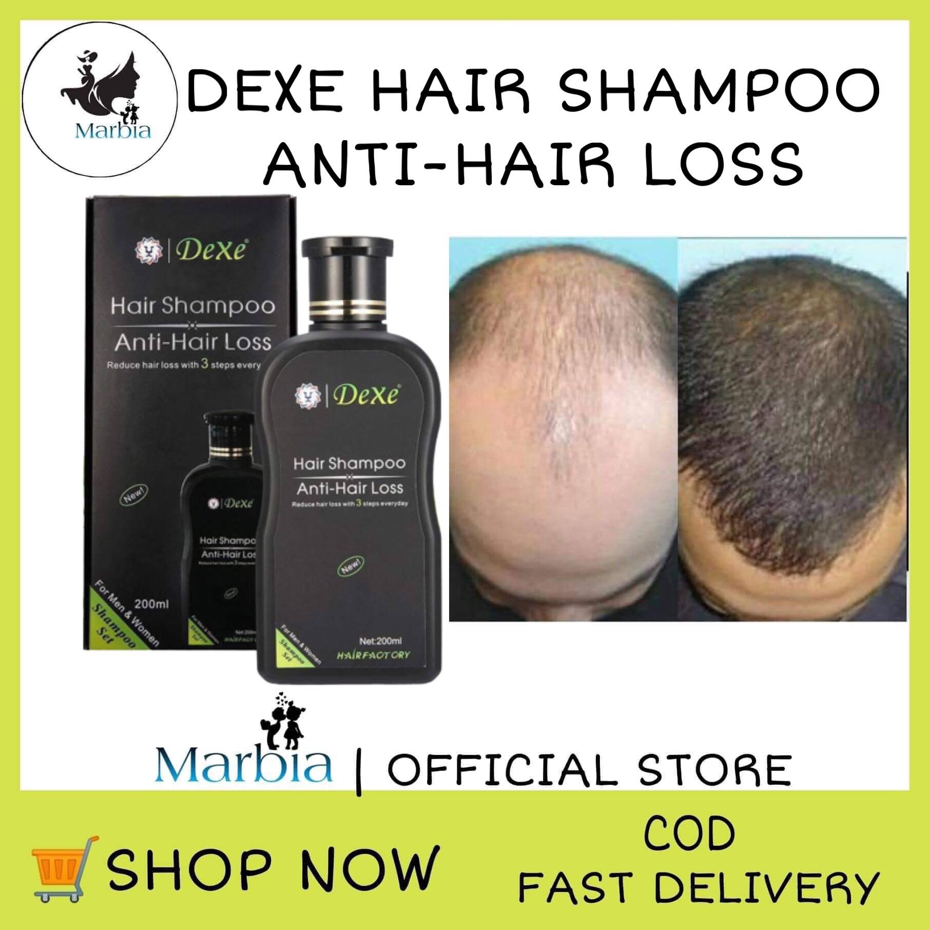 Effective Dexe Anti Hair Loss Shampoo With Advance Formula 200ml, Hair 