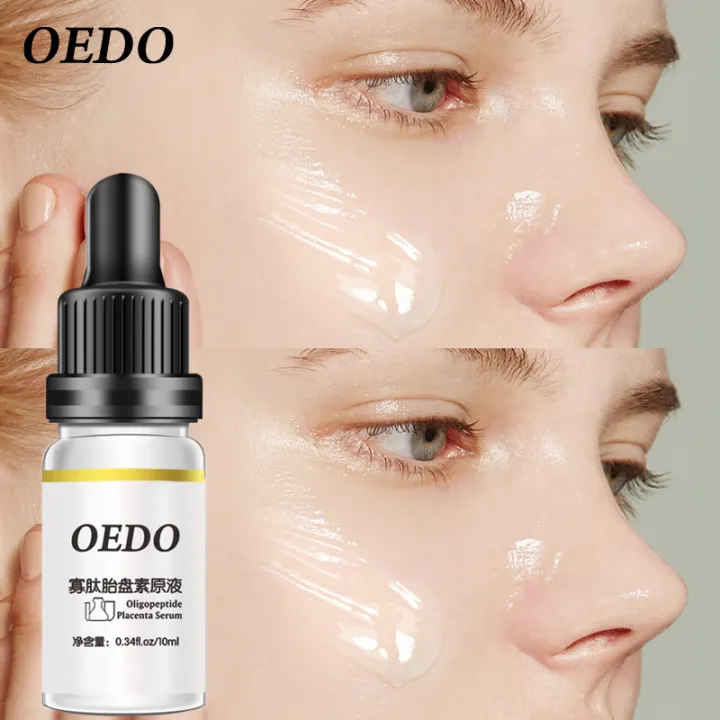 oligopeptide acne serum