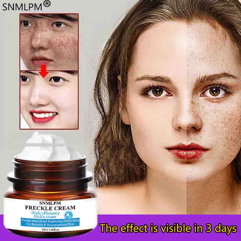 Dark spot eraser！SNMLPM Freckle Remover Cream Effective Whitening