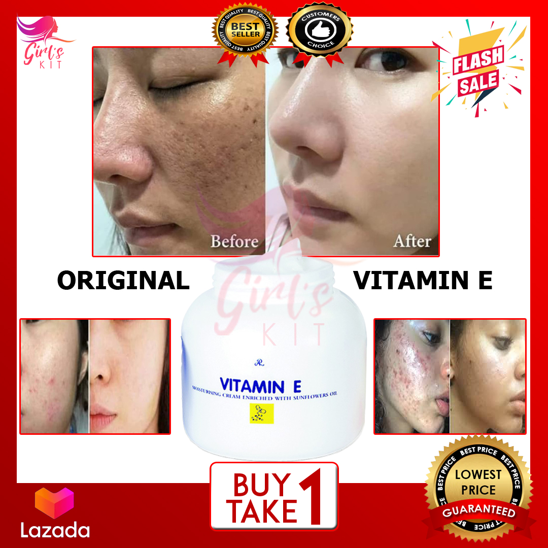 before and after vitamin e cream