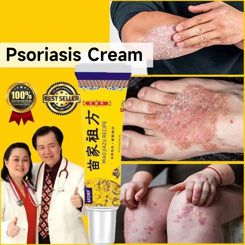 Psoriasis Eczema Treatment Cream 20g For The Treatment Of Skin 