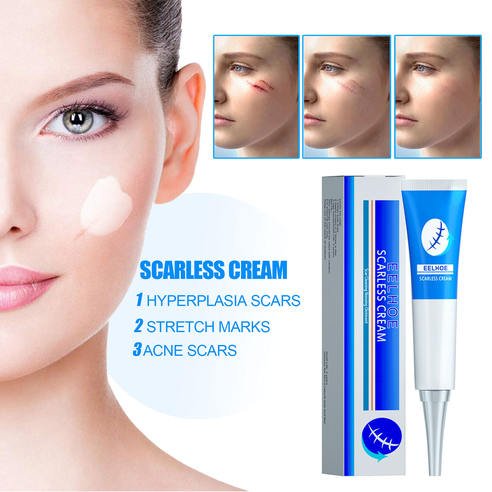 Eelhoe Scar Removal Cream Repair Skin Fading Scar Soothing Marks Smooth ...