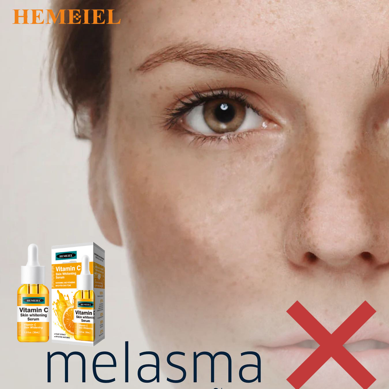 HEMEIEL Vitamin C Serum/Melasma Remover/Melasma Removal Serum/Brilliant
