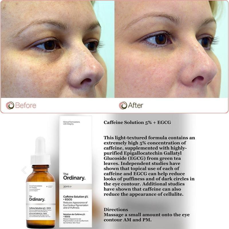 the ordinary products for under eyes