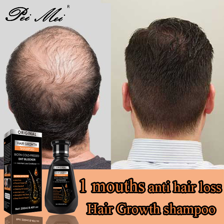 PEIMEI Ginger Shampoo for Hair Growth, Improves Nutrient Supply and  Strengthen The Roots of The Hair, Hair Grower for Men Original and Women  Effective. Gives You a Thick and Shiny Hair. |