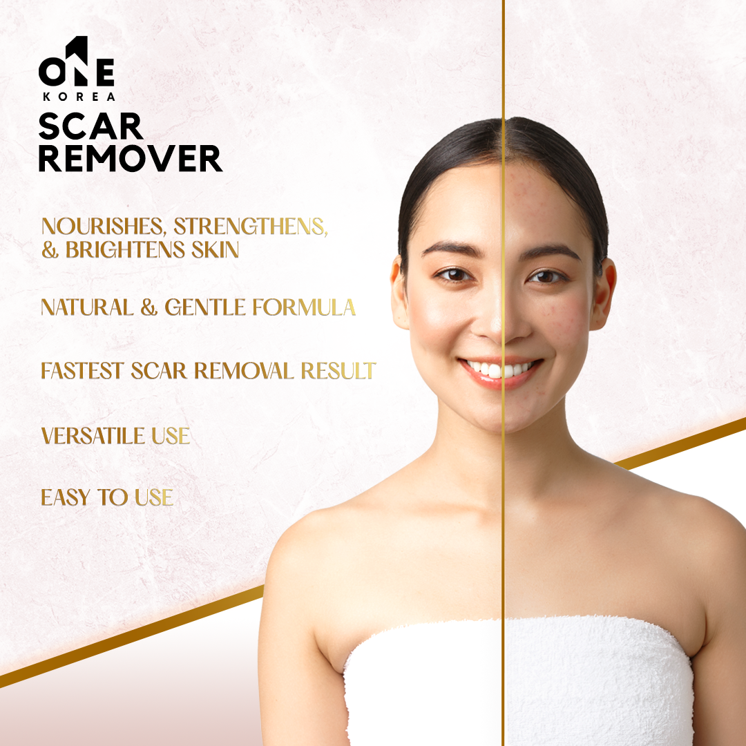 130 PCS ONEKII One Korea Scar Remover Cream Acne Treatment Whitening