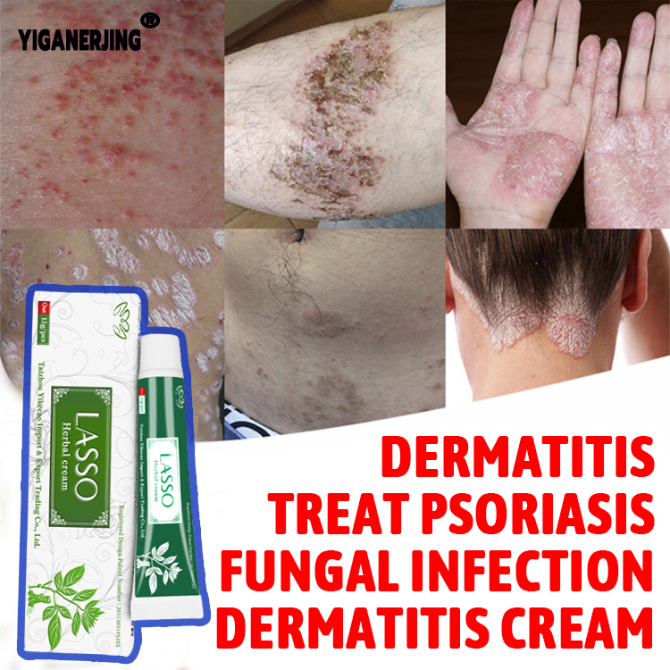 YIGANERJING ointment for itchy skin and allergy，skin disease ointment