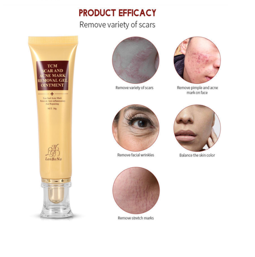 tcm acne scar removal cream price