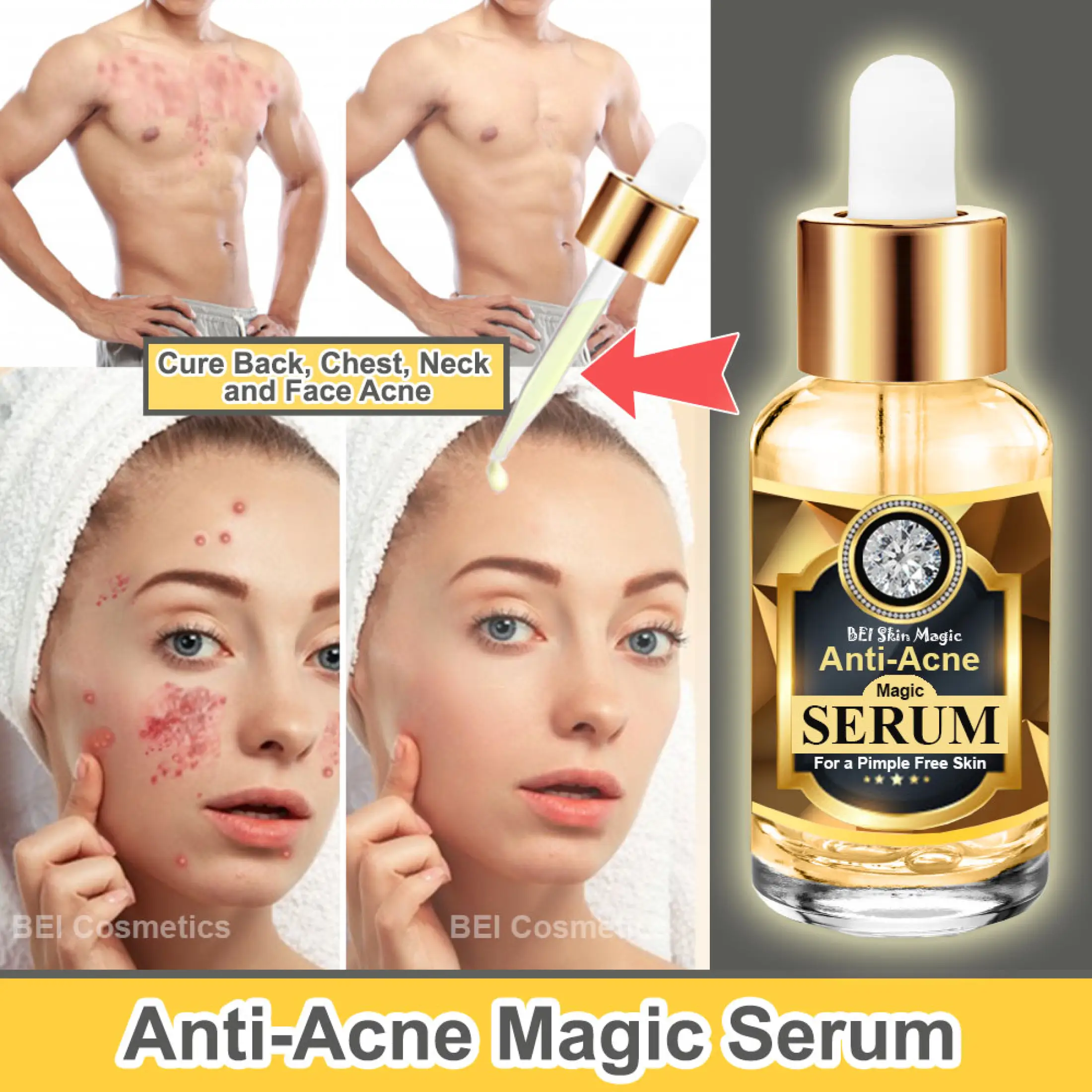 ordinary anti acne serum