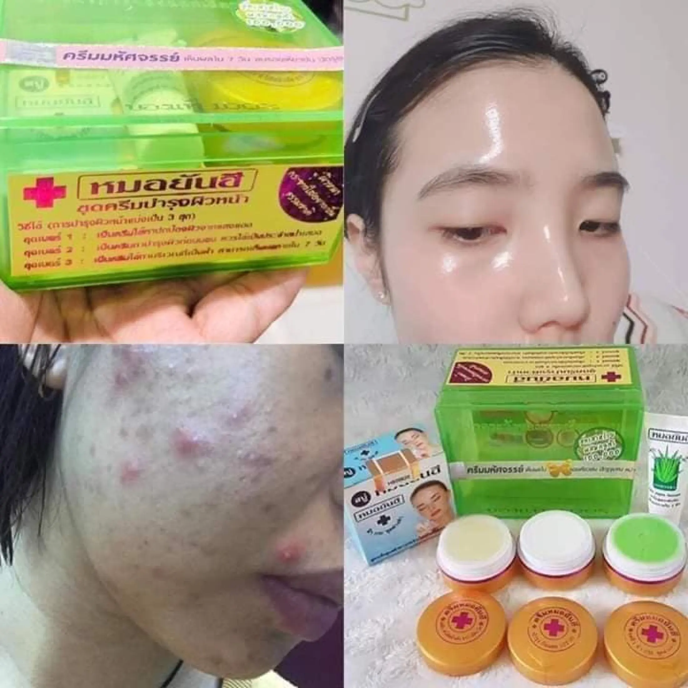 dr yanhee acne set