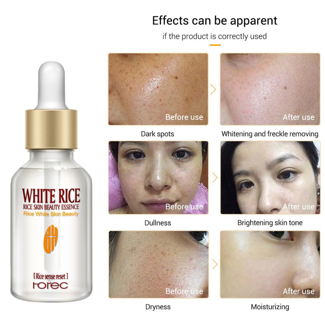 authentic rorec white rice serum