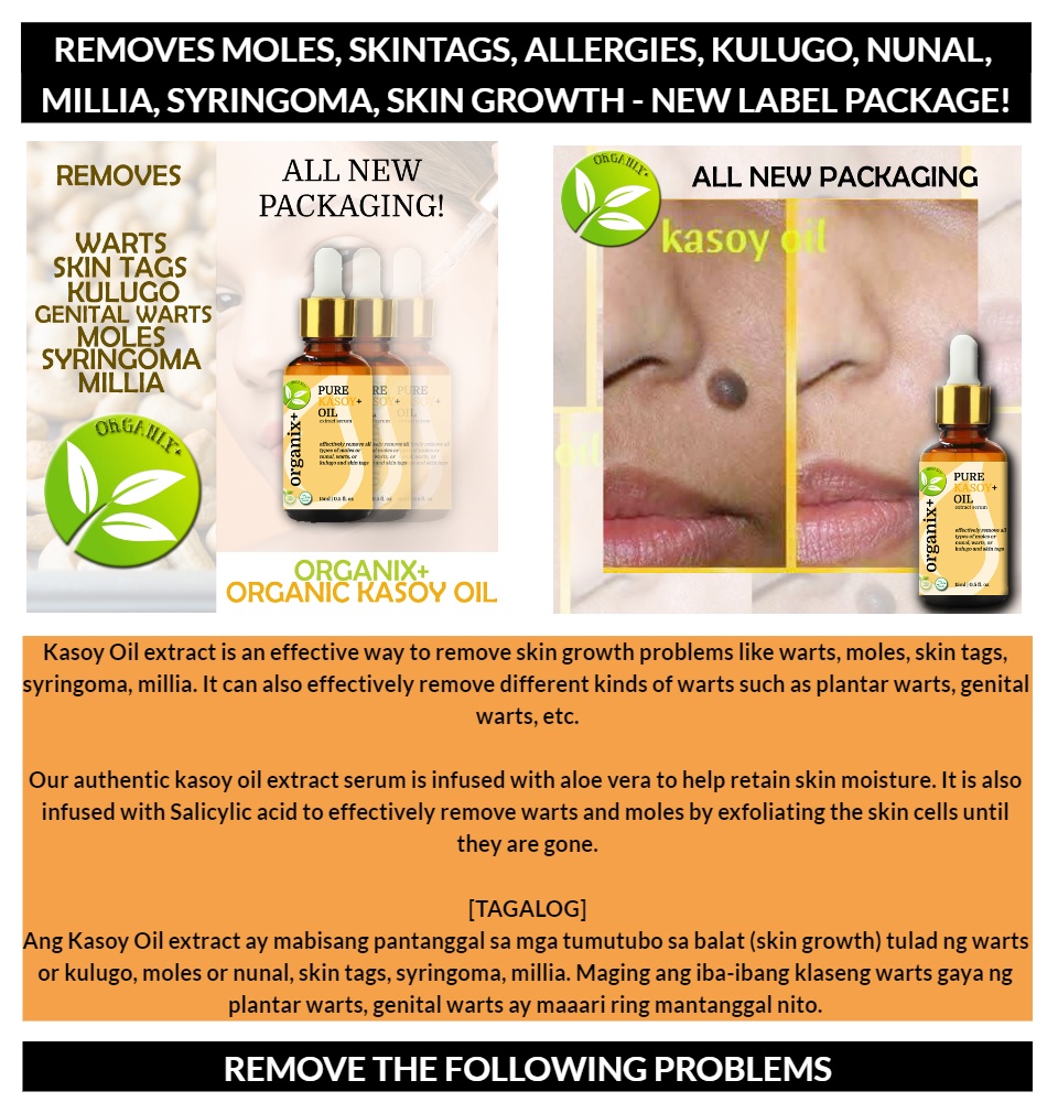 Jinsiy aloqada bolgan ikki lezbiyen video