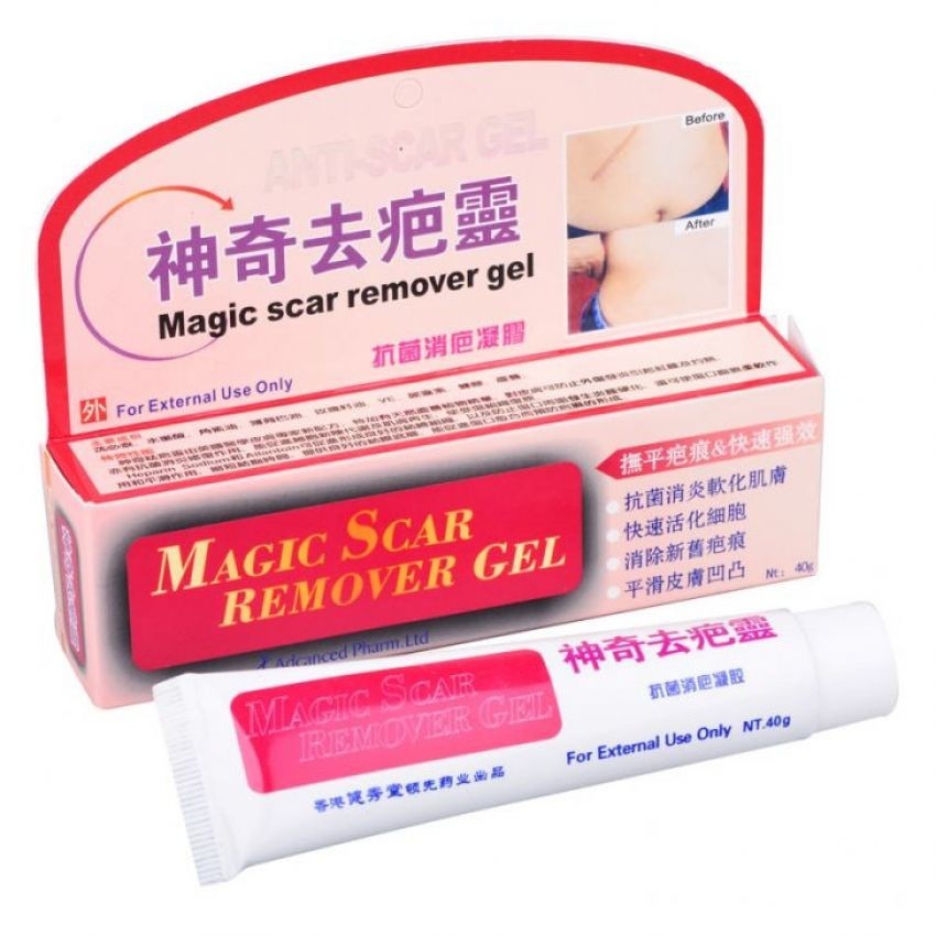 acne scar remover watsons