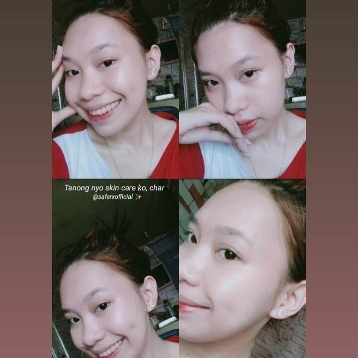 saferx korean skincare