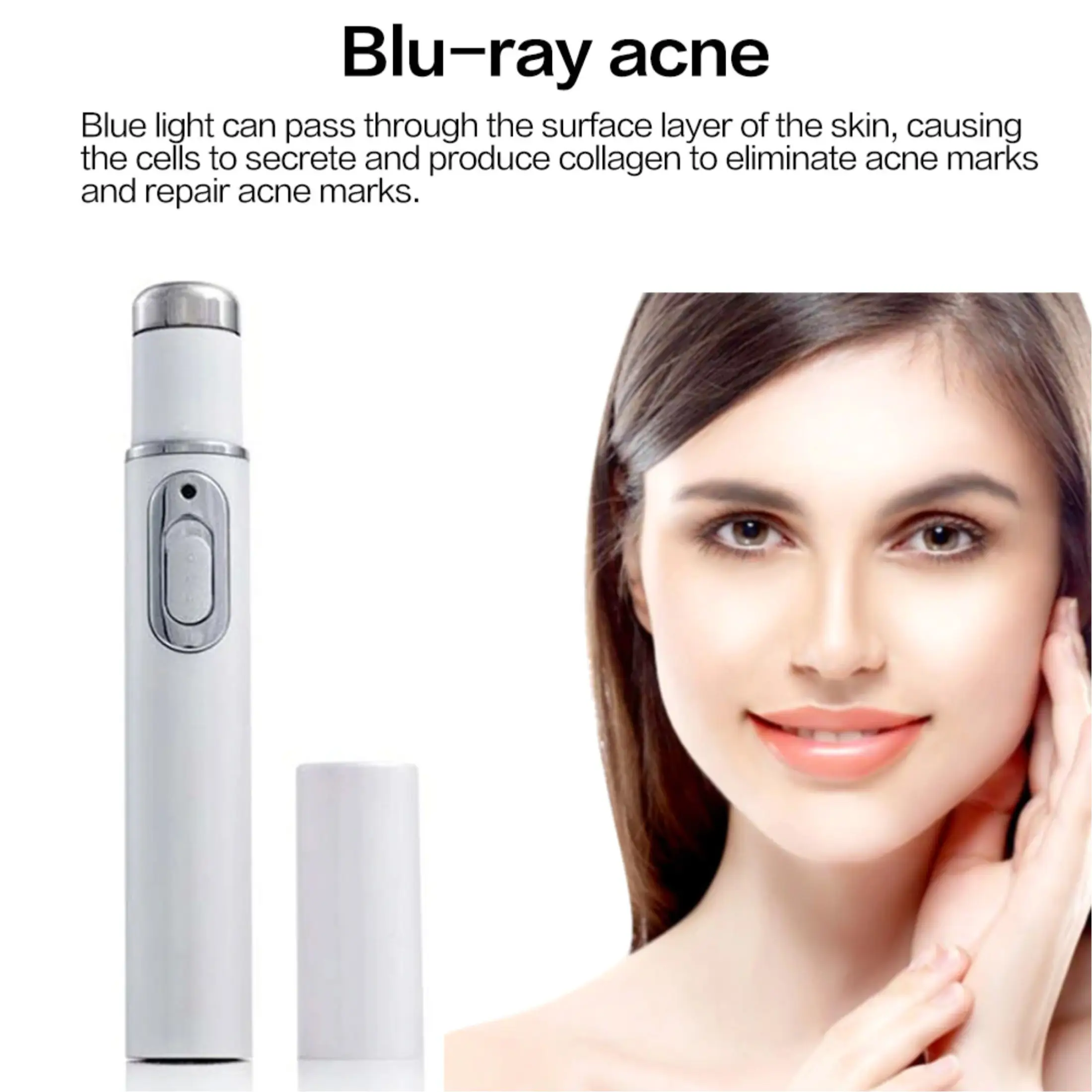 blue light therapy for acne